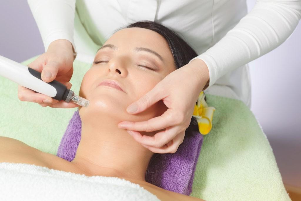 Microneedling is a dermatological procedure